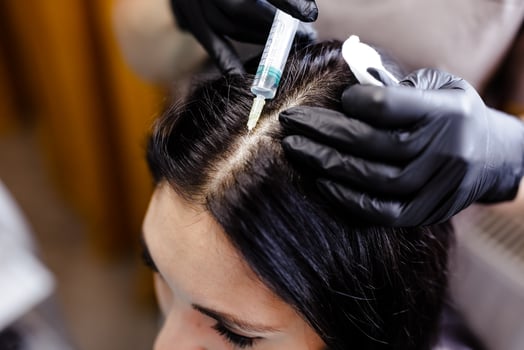 Woman Receiving Hair Restoration Injections at Beauty Salon photo