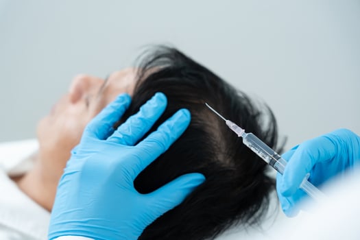 Specialist of hair injection hair tonic for Asian man, damaged hair, hair loss, thinning problem, vitamin deficiency, baldness, postpartum, biotin, zinc, endocrine disorders, hormonal imbalance photo