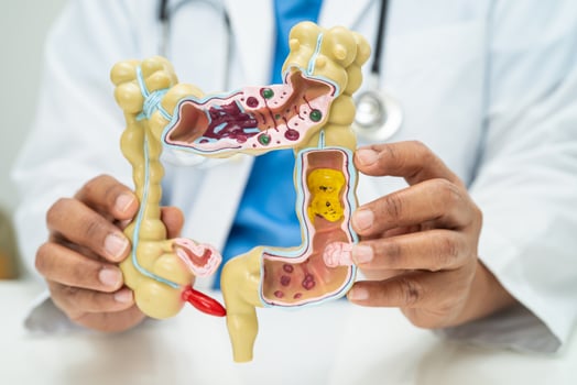 Intestine, appendix and digestive system, doctor holding anatomy model for study diagnosis and treatment in hospital. photo