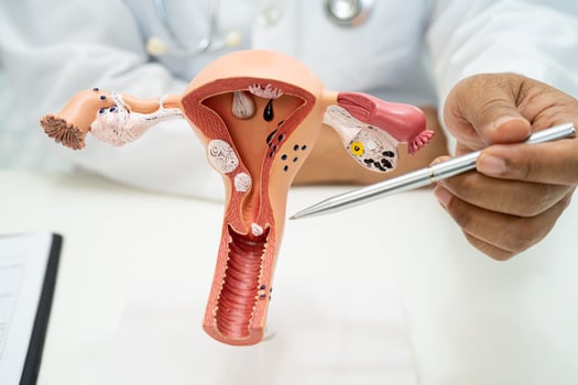Uterus, doctor with anatomy model for study diagnosis and treatment in hospital. photo