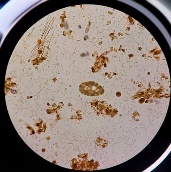 Close-up view of various microorganisms under a microscope, showcasing bacteria and other tiny particles. photo