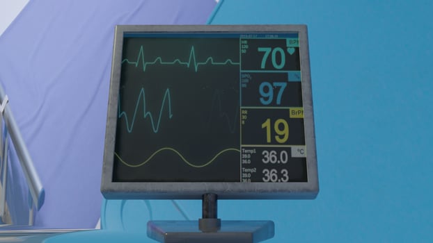 monitor with heart rate lcd photos