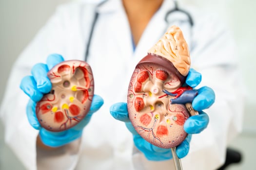 Kidney disease, Chronic kidney disease ckd, Doctor hold human model to treat and study in hospital. photo