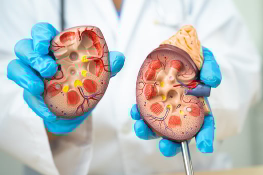 Kidney disease, Chronic kidney disease ckd, Doctor hold human model to treat and study in hospital. photo