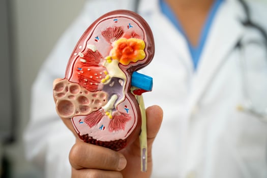 Kidney disease, Chronic kidney disease ckd, Doctor hold human model to treat and study in hospital. photo