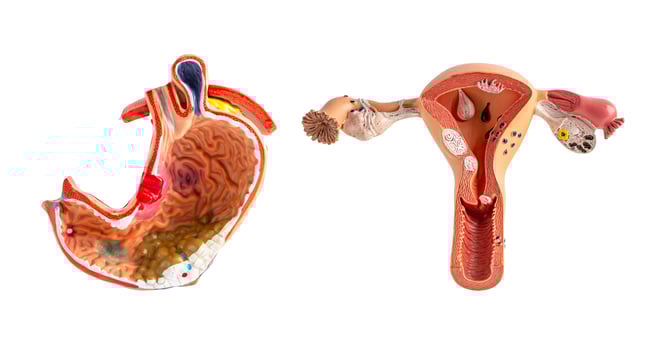 Stomach and uterus anatomy model for study diagnosis and treatment in hospital. photo