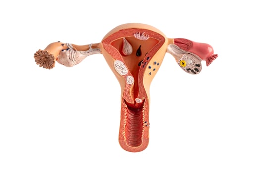 Model of the human uterus isolated on white background with clipping path, Cardiovascular disease CVD. photo