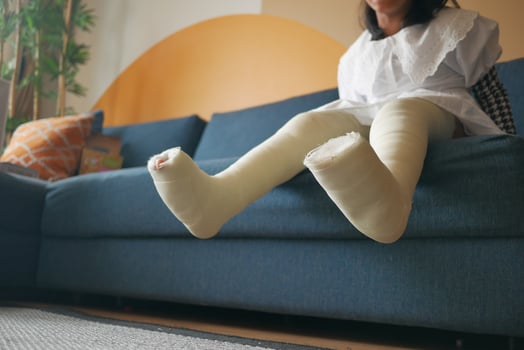 little child with plaster bandage on leg. photo