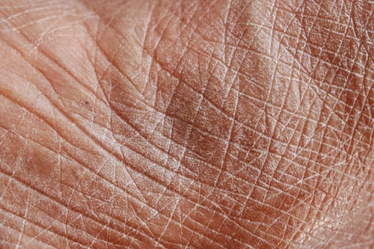 Closeup view of dry human skin . photo