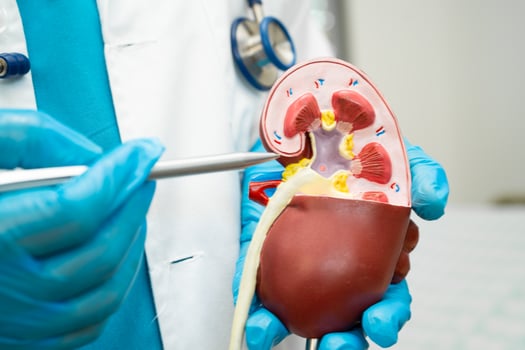 Kidney disease, Chronic kidney disease ckd, Doctor hold human model to treat and study in hospital. photo