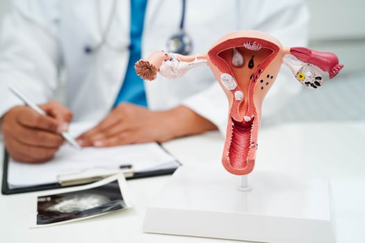 Uterus, doctor holding human anatomy model for study diagnosis and treatment in hospital. photo