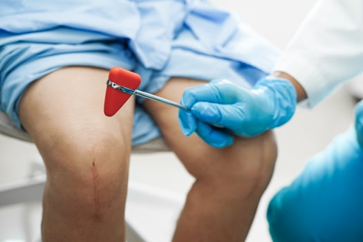Asian doctor knock on knee reflex nerve for check and treatment senior patient in hospital. photo