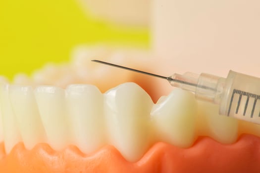 Injection of an anesthetic drug into the gum of a diseased tooth for treatment and surgery. Dental anesthesia in dentistry, freezing, macro. Copy space for text photo