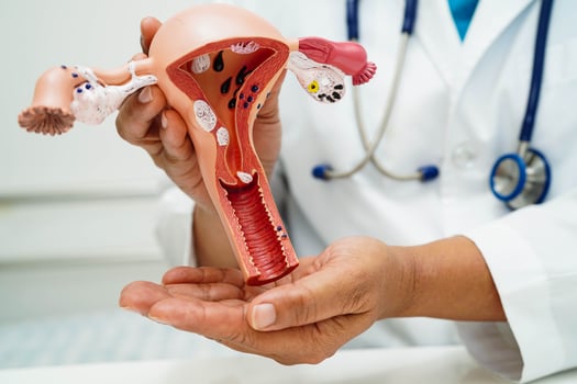 Uterus, doctor holding human anatomy model for study diagnosis and treatment in hospital. photo