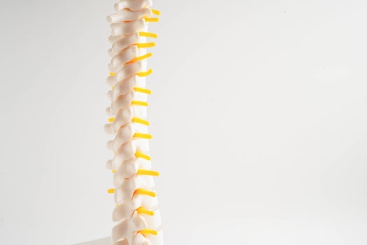 Spinal nerve and bone, Lumbar spine displaced herniated disc fragment, Model for treatment medical in the orthopedic department. photo