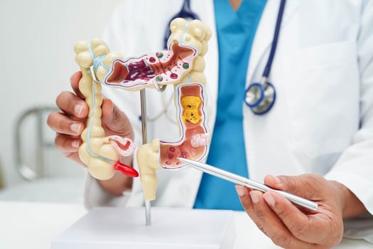 Intestine, doctor holding human anatomy model for study diagnosis and treatment in hospital. photo