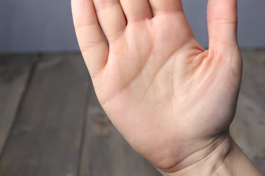 A close-up of a woman's palm. Hand care problems photo