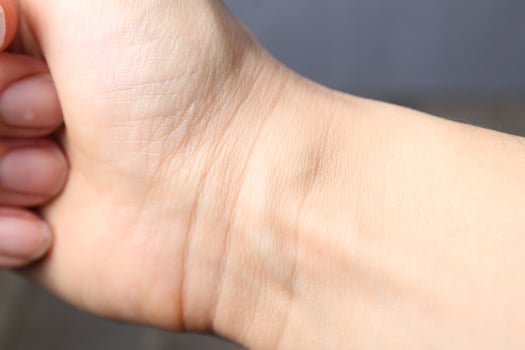 Close-up of a woman's wrist. Treatment of hand skin photo