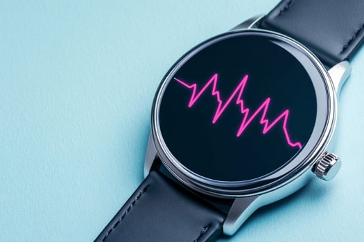 Digital watch displaying heart rate monitor app with bright ECG line for fitness tracking photo