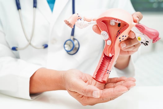 Uterus, doctor holding human anatomy model for study diagnosis and treatment in hospital. photo
