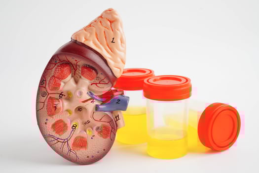Urinalysis, Kidney and urine cup for check health examination in laboratory. photo