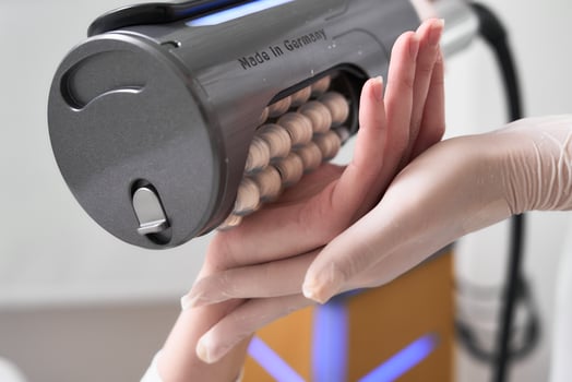 Hand treatment session with a specialized device in a clinical setting photo