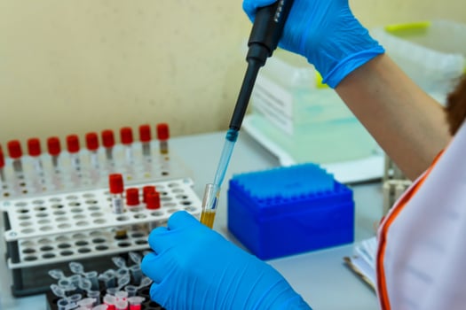 Modern blood test laboratory. Analyzing samples technologies. photo