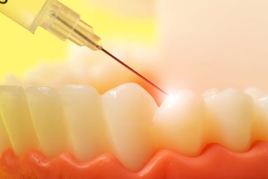 Injection of an anesthetic drug into the gum of a diseased tooth for treatment and surgery. Dental anesthesia in dentistry, freezing, macro. Copy space for text photo