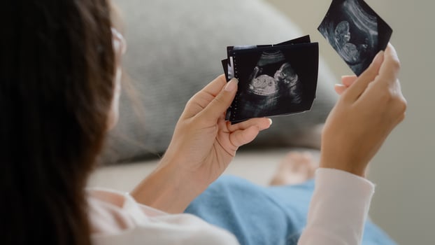 Back view pregnant unrecognizable fertile woman girl future mother wife sitting on sofa at home watching ultrasound pictures of germ child enjoying unborn baby photos ultrasonography medicine service