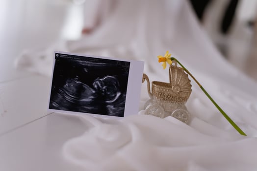 A photo of a baby in a stroller and a flower
