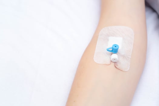 Intravenous catheter on the girl's arm for convenient injection of drugs into a vein, copy space for texr photo