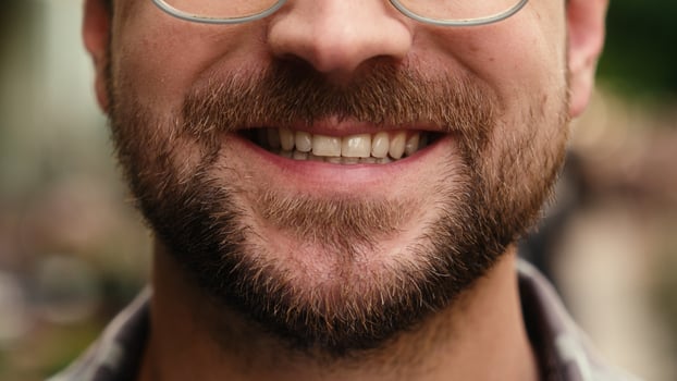 Close up male mouth guy bearded face details Caucasian happy man lips teeth surgery health care medical insurance healthy toothy smiling dental oral whitening smile beard grooming cropped shot in city photo