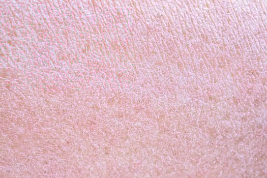 dry and dehydrated human skin texture background photo