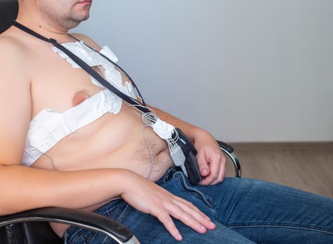 An obese man undergoes a Holter monitoring of the heart. Control of blood supply and disorders of the heart after myocardial infarction, electrocardiogram photo