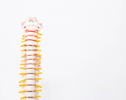 Cervical and thoracic spine on a white background. Intervertebral hernia of the cervical spine, rupture of the fibrous ring. Osteochondrosis, copy space photo