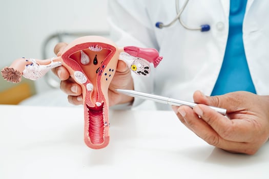 Uterus, doctor holding human anatomy model for study diagnosis and treatment in hospital. photo