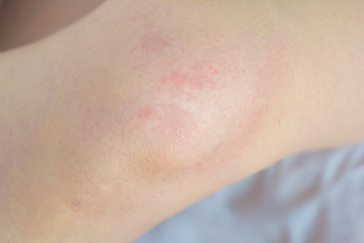 Kneeling, female legs of the knees photo
