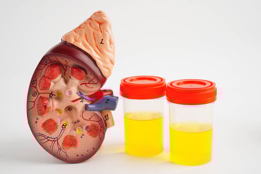Urinalysis, Kidney and urine cup for check health examination in laboratory. photo