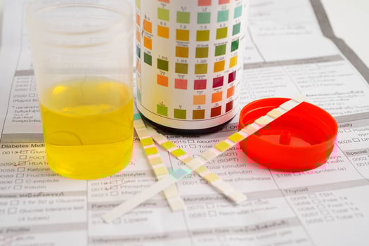 Urinalysis, urine cup with reagent strip pH paper test and comparison chart in laboratory. photo