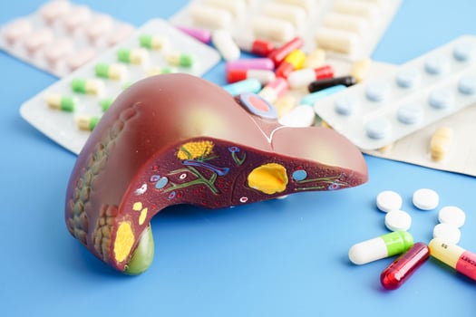 Liver model with pill drug treatment, Cirrhosis, Liver cancer, fatty liver. photo