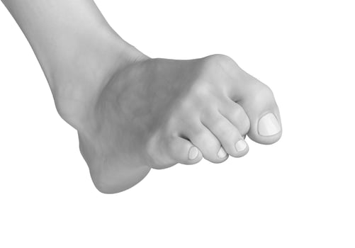 Gray foot with tense toes and ankle. Barefoot model showing inward posture, stress, and cramp. photo