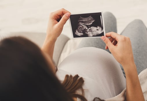 Pregnant woman looking at her baby sonography. Unrecognizable expectant lady enjoying first photo of her unborn child, anticipating her future life, copy space
