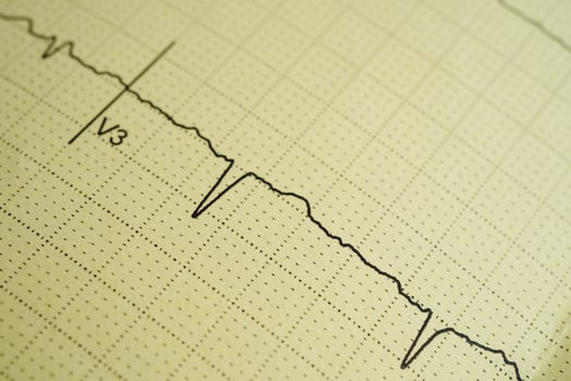 Electrocardiogram , heart wave, heart attack, cardiogram report. photo