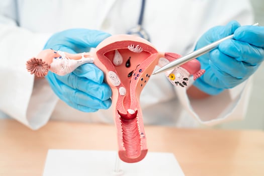 Uterus, doctor holding human anatomy model for study diagnosis and treatment in hospital. photo