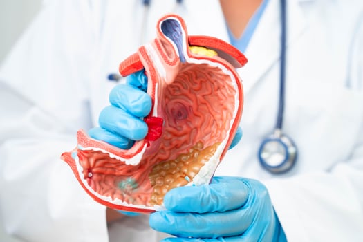 Stomach disease, doctor holding anatomy model for study diagnosis and treatment in hospital. photo