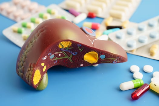 Liver model with pill drug treatment, Cirrhosis, Liver cancer, fatty liver. photo