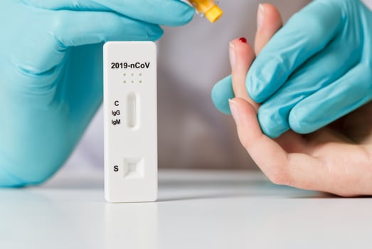 Doctor taking patient blood from finger for quick covid test. Covid rapid test. quick Rapid Diagnostic Test RDT photo