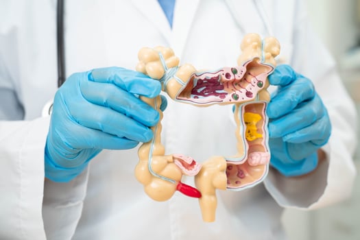 Intestine, doctor holding human anatomy model for study diagnosis and treatment in hospital. photo