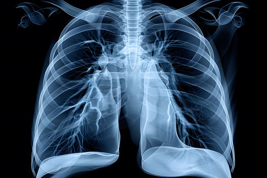 X-Ray Image of Human Lungs and Ribcage - Medical Diagnostic Radiography photo