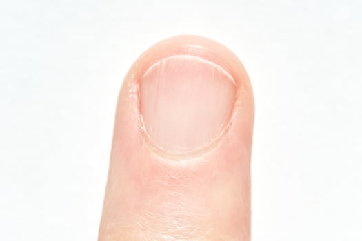 Close up view of a human fingernail on a caucasian adult finger. photo
